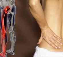 Болки в гърба, излъчваща на крака: Причини, Лечение