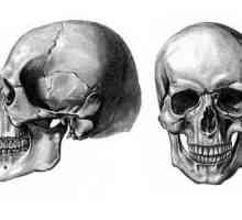 Череп: съединението на черепните кости. Видове черепните връзки