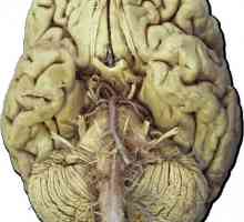 Черепните нерви, 12 чифта: анатомия, таблични функции