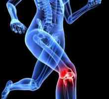 Какво е деформиран остеоартрит на коляното?