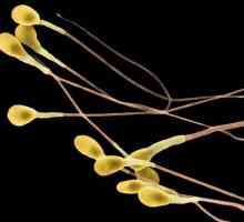 Какво е сперма? Особености на мъжкия гамети