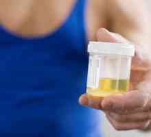 Урината изход - какво е това? Симптоми и лечение