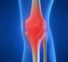 Дауа коляното: причини, симптоми на различни етапи от лечението