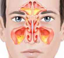 Двустранни синузит: симптоми и лечение
