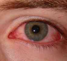 Как да се отървем от синдром на сухото око?