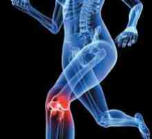 Ставата на коляното. Сухожилие разкъсване: степента на увреждане и лечения