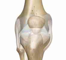Кръстни връзки на коляното: травми, лечение, рехабилитация