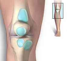 Лечение на бурсит на коляното: върнете лесно походка