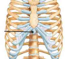 Мечовиден гръдната кост се увеличава - как да бъде?
