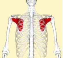 Subscapularis мускул: разполага снимка. Повреда на мускул subscapularis: Лечение