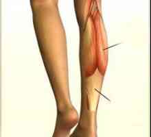 Прасците, тяхното местоположение, функция и структура. предни и задни мускули на краката групи