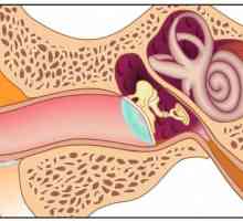 Сензорна загуба на слуха: Причини и лечение