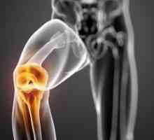 Последици от травми на коляното. Протезиране и рехабилитация