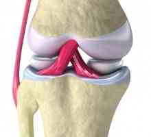 Причини и симптоми на синовит на колянната става