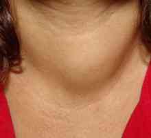 Проблеми с щитовидната жлеза. Симптоми и методи на лечение