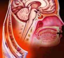 Симптоми, причини и лечение на гноен менингит при възрастни и деца