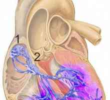 Синоатриално блок: причини, лечение. Нарушения в сърдечния ритъм