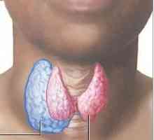 Нодуларна гуша на щитовидната жлеза: причини, симптоми и лечение