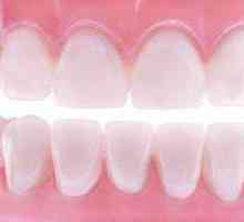 Зубныя мяккія пратэзы: водгукі спецыялістаў, фота