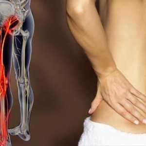 Болки в гърба, излъчваща на крака: Причини, Лечение