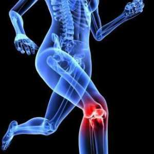 Какво е деформиран остеоартрит на коляното?