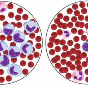 В червените кръвни клетки намалява: възможни причини