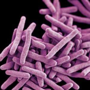 Как да се определи от туберкулоза на ранен етап?