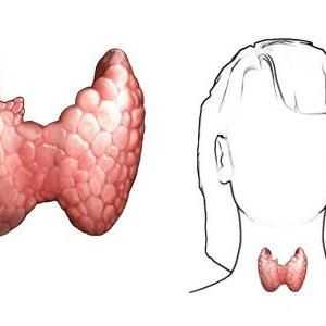 Какви са симптомите на заболяване на щитовидната жлеза за жени