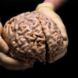 Човешкият мозък: структура