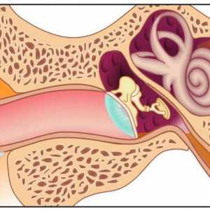 Сензорна загуба на слуха: Причини и лечение