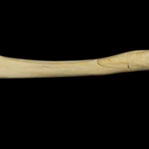 Tubular кости: структура и функция. Дългите кости