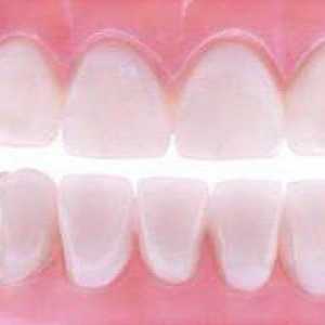 Зубныя мяккія пратэзы: водгукі спецыялістаў, фота